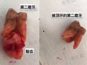 在线观看智齿,揭秘在线观看时代的秘密武器 第2张 在线观看智齿,揭秘在线观看时代的秘密武器 第2张