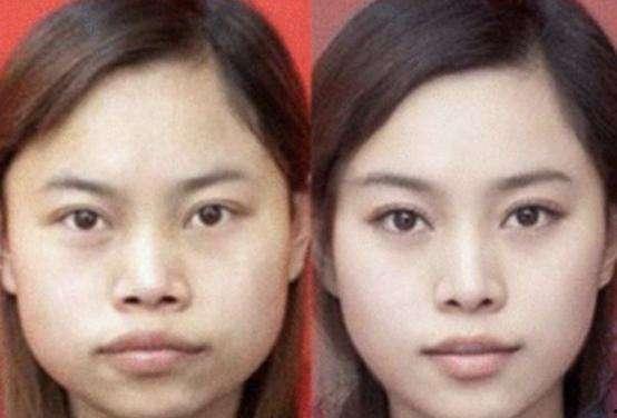 西安整容爆料案件最新,揭开医美行业潜规则与患者权益受损之谜 第2张 西安整容爆料案件最新,揭开医美行业潜规则与患者权益受损之谜 第2张