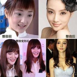 西安整容爆料案件最新,揭开医美行业潜规则与患者权益受损之谜 第3张 西安整容爆料案件最新,揭开医美行业潜规则与患者权益受损之谜 第3张